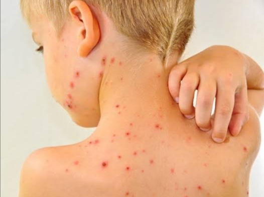 Ilustrasi. Foto: Istimewa