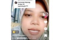 Unggahan hoaks yang menyatakan tepung terigu sebagai pertolongan pertama pada luka bakar. Faktanya, tepung terigu dapat menyebabkan infeksi jika ditaburkan pada area luka di tubuh. Foto: TikTok