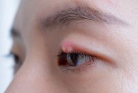 Mata Bintitan. Foto: Istimewa 