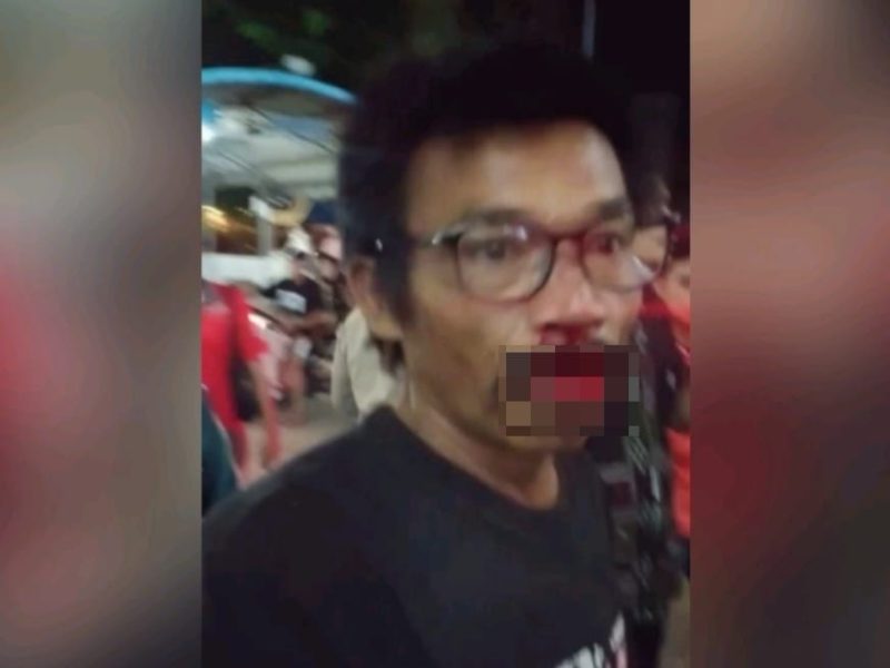 Anthonius Ari Rejeki Lumban Gaol korban pengeroyokan oleh sejumlah security SP Plaza. Foto: Dok. Pribadi untuk INIKEPRI.COM