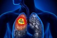 Ilustrasi. Foto: SHUTTERSTOCK 