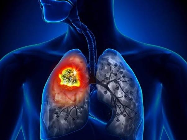 Ilustrasi. Foto: SHUTTERSTOCK 