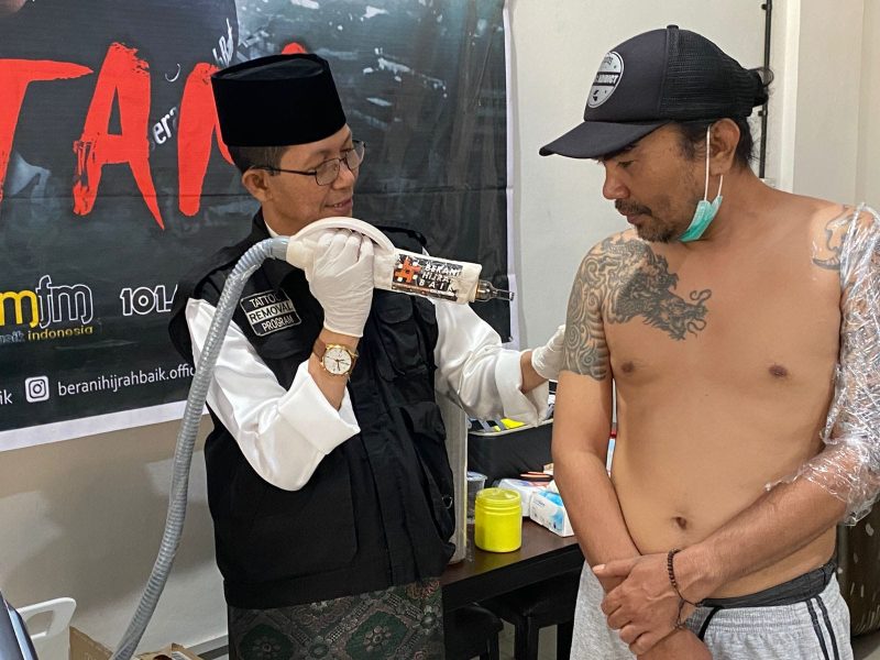 Wakil Wali Kota Batam Amsakar Achmad membuka program hapus tato gratis. Foto: INIKEPRI.COM 