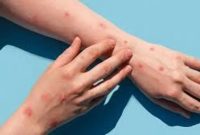 Ilustrasi. Foto: Istimewa 