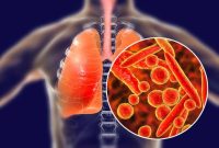 Ilustrasi. Foto: PEXELS