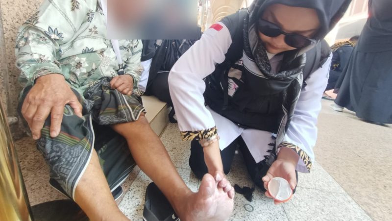 Kaki jemaah melepuh karena berjalan tanpa alas kaki di Madinah. Foto: Kemenag/Istimewa