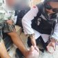 Kaki jemaah melepuh karena berjalan tanpa alas kaki di Madinah. Foto: Kemenag/Istimewa