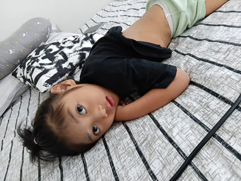 Salah satu anak tengah menunggu giliran fisioterapi di rumah singgah Ar-Rahman Rusli dan Firza Paloh. Foto: INIKEPRI.COM