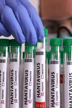 Kasus Muncul di Beberapa Negara, Benarkah Hantavirus Jadi Covid-19 Berikutnya?